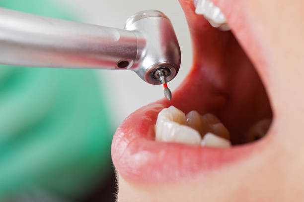 Best Pediatric Emergency Dentist in Manor, TX